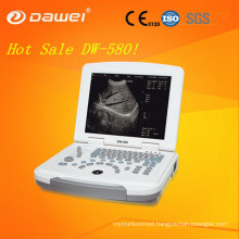2D portable ultrasound machine price & cheapest black and white mobile ultrasonic equipment